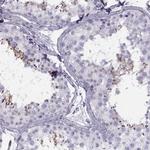 FAM24B Polyclonal Antibody