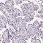 OGDHL Antibody in Immunohistochemistry (Paraffin) (IHC (P))