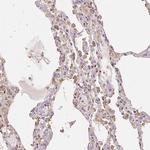 XAGE2 Antibody in Immunohistochemistry (Paraffin) (IHC (P))