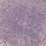 XAGE2 Antibody in Immunohistochemistry (Paraffin) (IHC (P))