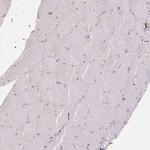 XAGE2 Antibody in Immunohistochemistry (Paraffin) (IHC (P))