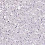 ZG16 Antibody in Immunohistochemistry (IHC)