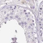 ZG16 Antibody in Immunohistochemistry (IHC)