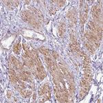 DIP2A Antibody in Immunohistochemistry (Paraffin) (IHC (P))