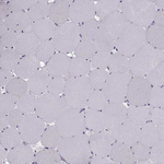 ROPN1B Polyclonal Antibody