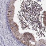 ROPN1B Antibody in Immunohistochemistry (IHC)