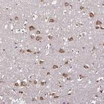RPL38 Antibody in Immunohistochemistry (Paraffin) (IHC (P))