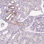 OR2AK2 Polyclonal Antibody