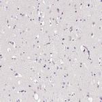 CYBASC3 Antibody in Immunohistochemistry (Paraffin) (IHC (P))