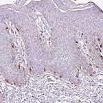 CYBASC3 Antibody in Immunohistochemistry (Paraffin) (IHC (P))