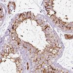 CYBASC3 Antibody in Immunohistochemistry (Paraffin) (IHC (P))