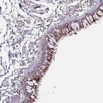OR2D3 Polyclonal Antibody
