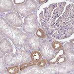 TMEM107 Polyclonal Antibody