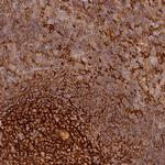 TMEM42 Polyclonal Antibody