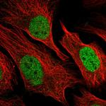 ZBTB44 Polyclonal Antibody