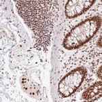 ZBTB44 Antibody in Immunohistochemistry (Paraffin) (IHC (P))