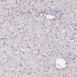 SGF29 Antibody in Immunohistochemistry (Paraffin) (IHC (P))