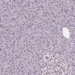 SGF29 Antibody in Immunohistochemistry (Paraffin) (IHC (P))