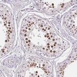 SGF29 Antibody in Immunohistochemistry (Paraffin) (IHC (P))