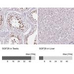 SGF29 Antibody in Immunohistochemistry (IHC)
