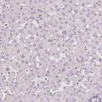 SGF29 Antibody in Immunohistochemistry (IHC)