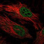 FBXO34 Polyclonal Antibody