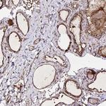 FBXO34 Antibody in Immunohistochemistry (Paraffin) (IHC (P))