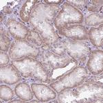 RNASE10 Polyclonal Antibody