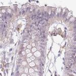 TMEM237 Antibody in Immunohistochemistry (IHC)
