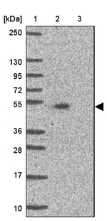 TMEM237 Antibody in Western Blot (WB)