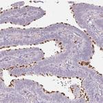 TMEM237 Polyclonal Antibody