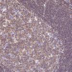 FAM228B Polyclonal Antibody