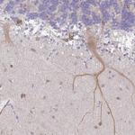 WSB2 Polyclonal Antibody