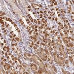 GCNT7 Polyclonal Antibody