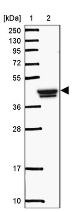 GCNT7 Antibody in Western Blot (WB)