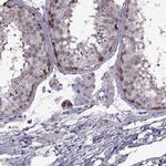 PAGE2B Polyclonal Antibody