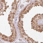 MZT2A Antibody in Immunohistochemistry (Paraffin) (IHC (P))