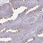 DNAH9 Antibody in Immunohistochemistry (IHC)