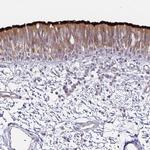 DNAH9 Antibody in Immunohistochemistry (IHC)