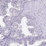 DNAH9 Antibody in Immunohistochemistry (IHC)
