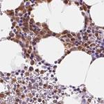 SERPINB1 Antibody in Immunohistochemistry (IHC)