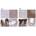 EPLIN Antibody in Immunohistochemistry (IHC)