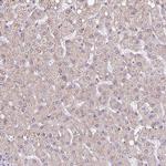 JPH2 Antibody in Immunohistochemistry (Paraffin) (IHC (P))