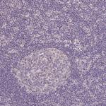 JPH2 Polyclonal Antibody