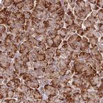 TBC1D2B Antibody in Immunohistochemistry (Paraffin) (IHC (P))