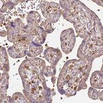 TBC1D2B Antibody in Immunohistochemistry (Paraffin) (IHC (P))