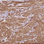 TBC1D2B Antibody in Immunohistochemistry (Paraffin) (IHC (P))