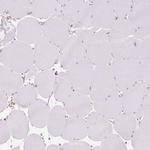 TBC1D2B Antibody in Immunohistochemistry (Paraffin) (IHC (P))