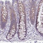 LPIN3 Polyclonal Antibody