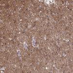 PRRT4 Polyclonal Antibody
